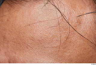 HD Face Skin Steven Hungan face forehead skin pores skin…